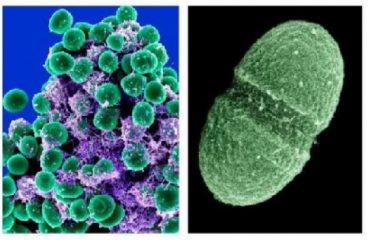 5 Fakta Mengejutkan Tentang Microbiome Di Tubuh Anda