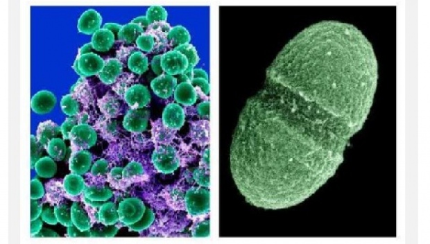 5 Fakta Mengejutkan Tentang Microbiome Di Tubuh Anda