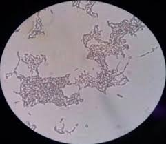 Penelitian Ekologi Mikroorganisme Bakteria