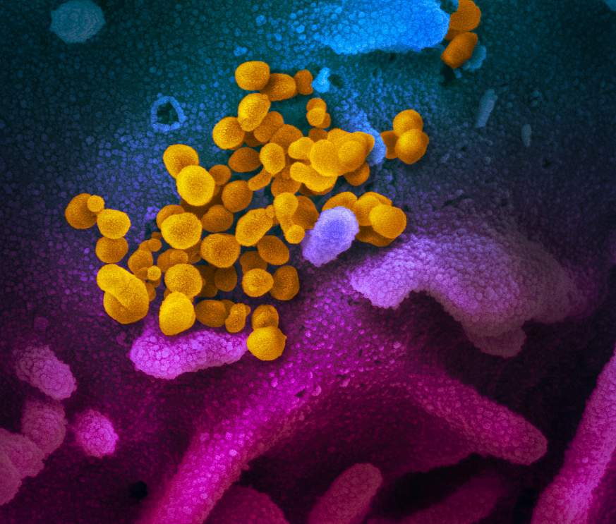 Studi Rumah Sakit Menunjukkan Bagaimana Bakteri Menyebar Di Antara Pasien, Staf, Permukaan